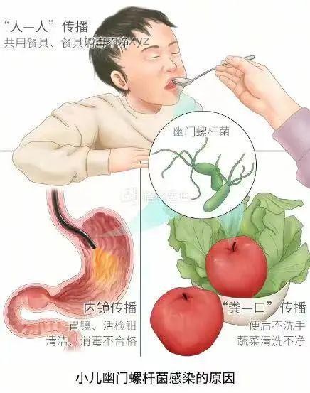 “这个细菌一人感染全家都得查”——幽门螺杆菌家庭感染案例研究