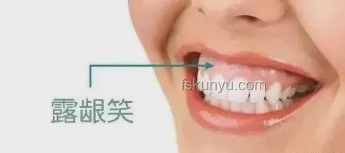 韦神牙周炎治疗：口腔健康新趋势预测